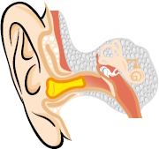 Abb. 20 Korrekt eingesetzter Gehrschutzstpsel