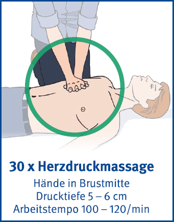 Herzdruckmassage